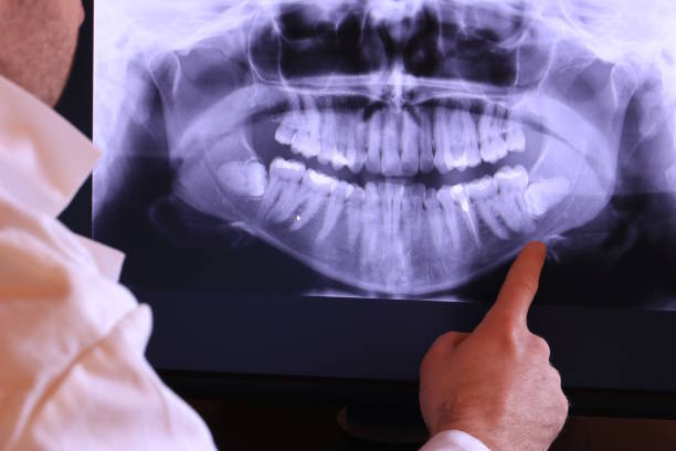Best Emergency Dental Services for Seniors in Clarcona, FL