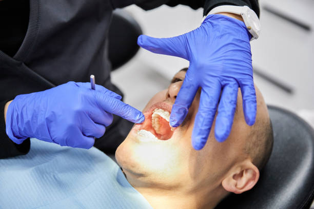 Best Emergency Dentist for Lost Fillings or Crowns in Clarcona, FL