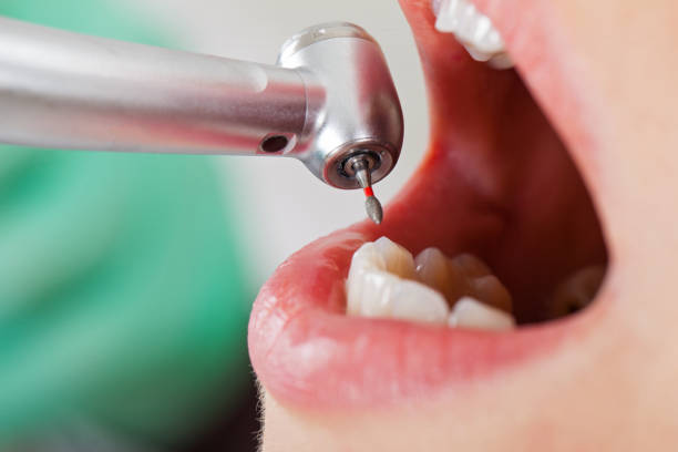 Best Pediatric Emergency Dentist in Clarcona, FL